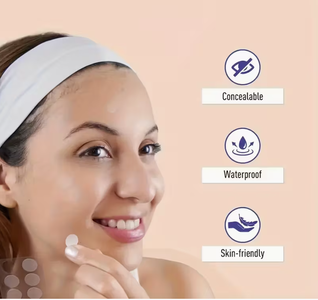 FreshFace Luxe Hydrocolloid Pimple Patches – 360pcs